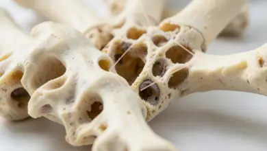 co je osteomalacie a jak ji léčit - Co je osteomalacie a - ilustrační foto