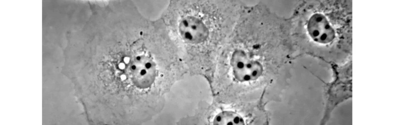 Microscopic cells with dark spots