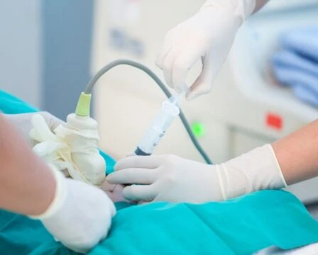 Ruce v rukavicích provádějí lékařský zákrok s jehlou během ultrazvuku.