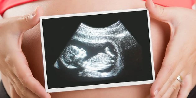 Těhotná žena drží ultrazvukový snímek s plodem v břiše.