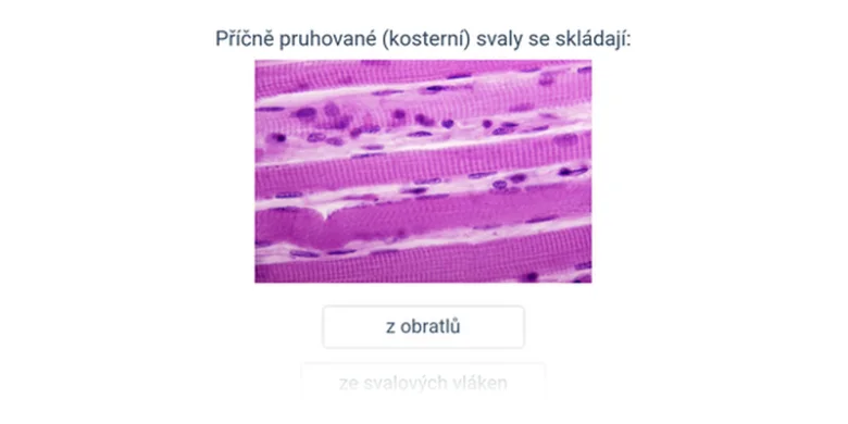 Mikroskopický snímek příčně pruhovaných svalových vláken s viditelnými pruhy.