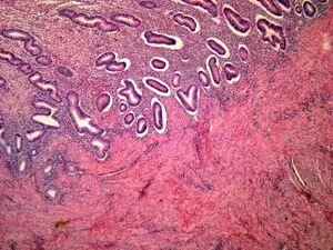 Histologický přípravek dělohy s žlázami a stromou pod mikroskopem.