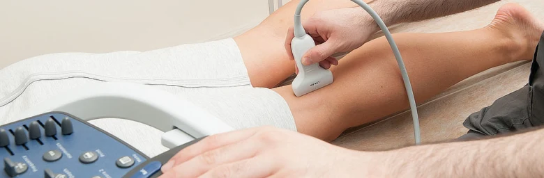 Ultrasound scan of leg vein