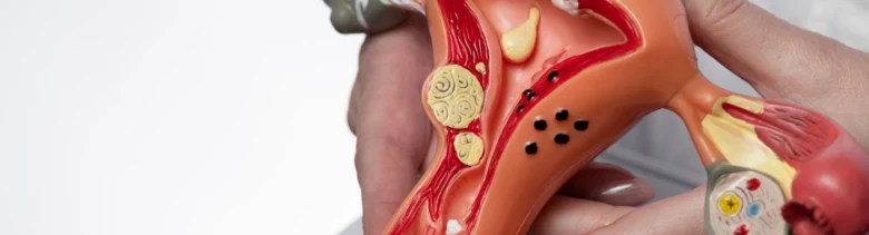 Anatomický model ukazující vnitřní orgány s několika žlutými cystickými útvary.