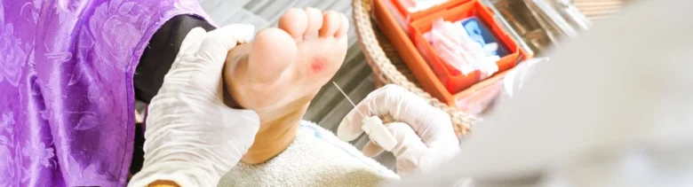 Lékař ošetřuje ránu na noze pacienta s diabetem.