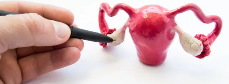 Model ženského reprodukčního systému s cystickou formací na vaječníku.