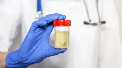 Ruce v rukavicích drží nádobu s močí pro vyšetření barvy.