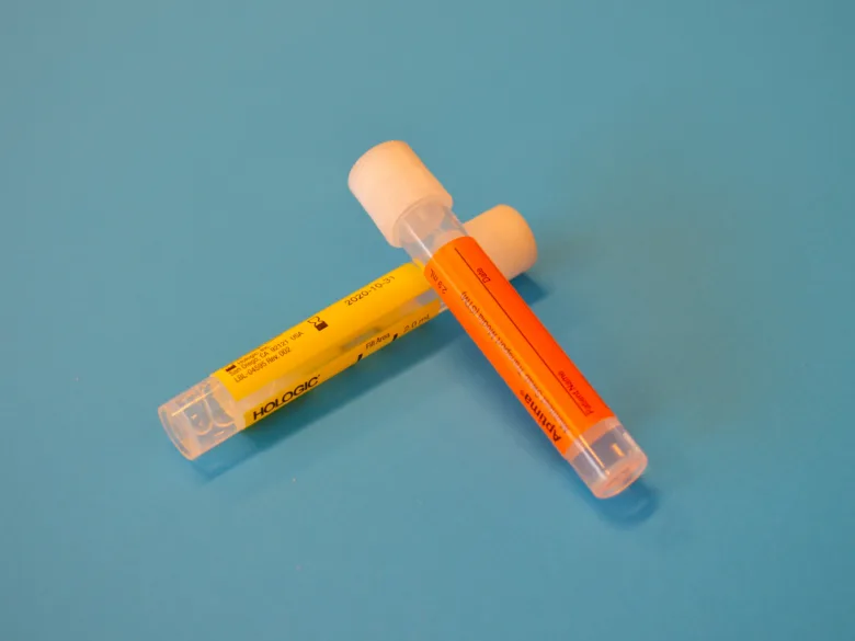 Dva žluté a oranžové nádobky na sběr moči pro laboratorní vyšetření.