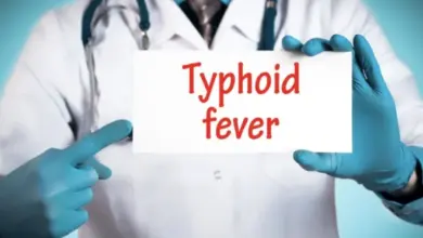Doctor holding sign typhoid fever