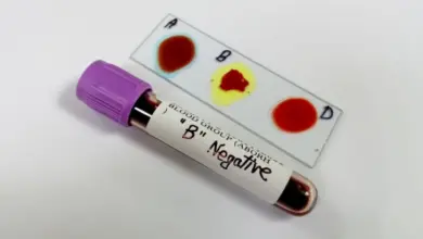 Krevní test pro skupinu B negativ s výsledky na sklíčku.