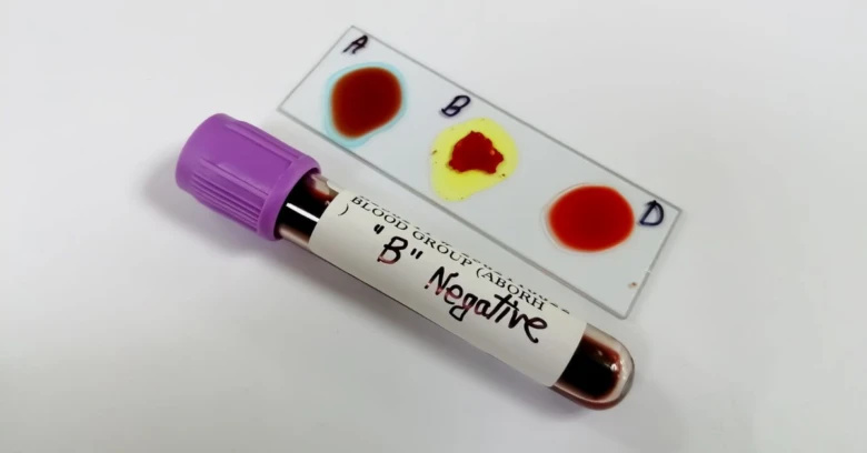 Krevní test pro skupinu B negativ s výsledky na sklíčku.