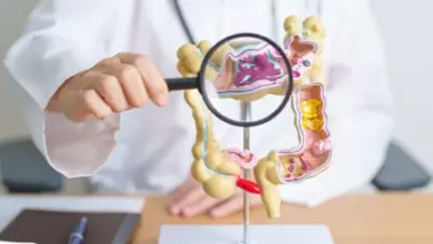 Medical model of colon with diverticula