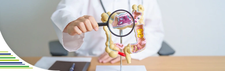 Medical model of colon with diverticula