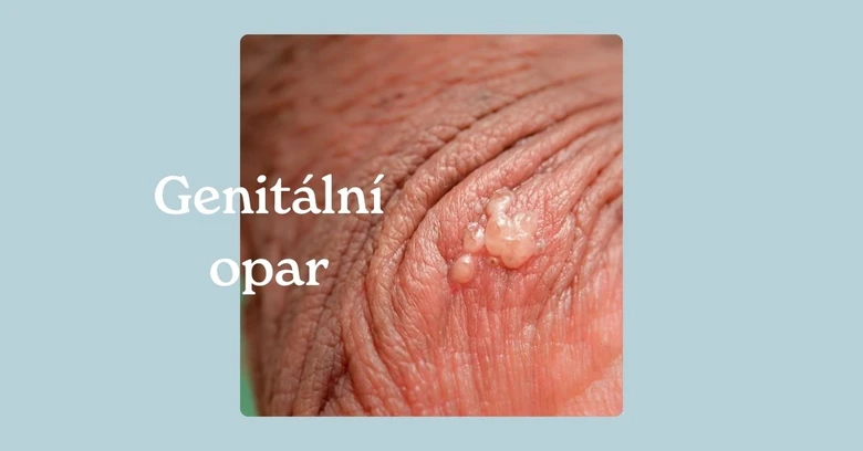 Fotografie genitálních oparů na kůži s českým popiskem.