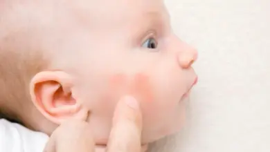 Babička s atopickým ekzémem na tváři.