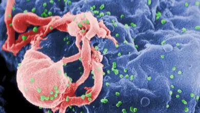 Zvětšený virus HIV na infikované buňce s virovými částicemi