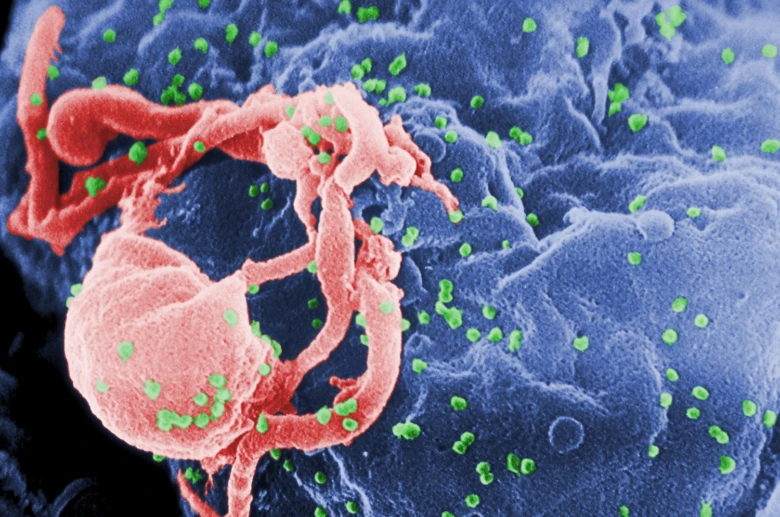 Zvětšený virus HIV na infikované buňce s virovými částicemi
