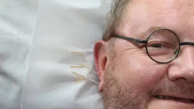 Muž s bradkou leží na gauči při akupunktuře ucha.