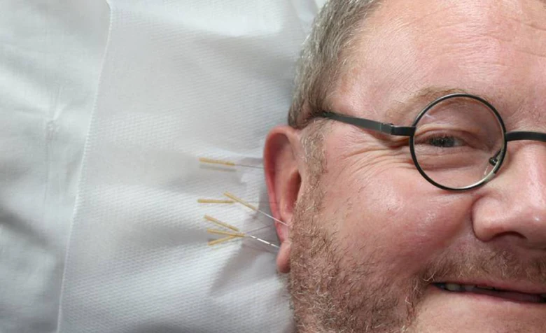 Muž s bradkou leží na gauči při akupunktuře ucha.
