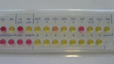 Testovací deska pro identifikaci bakterií ureaplazmy.