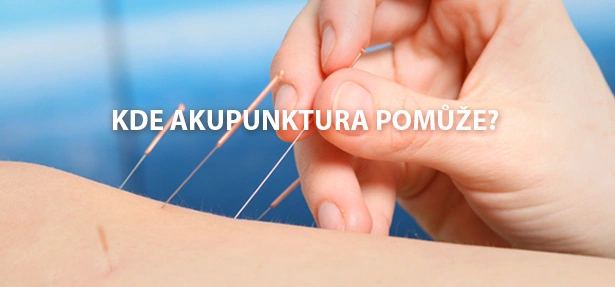 Ruční aplikace akupunkturních jehel na lidské paži.