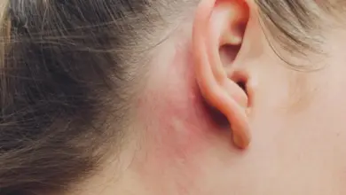 Zčervenání kůže za uchem při alergické kontaktní dermatitidě.