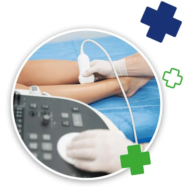 Ultrasound examination of leg vein