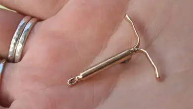 Zlaté nehormonální nitroděložní tělísko GyneFix v ruce