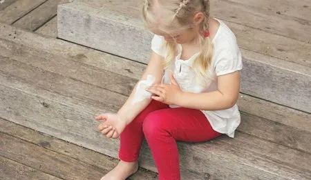 Dívka mazá krém na loket s atopickým ekzémem.