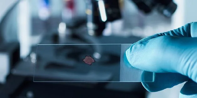 Ruka drží mikroskopický preparát s krví v laboratoři.
