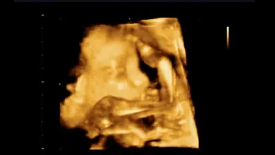 Fetal ultrasound scan